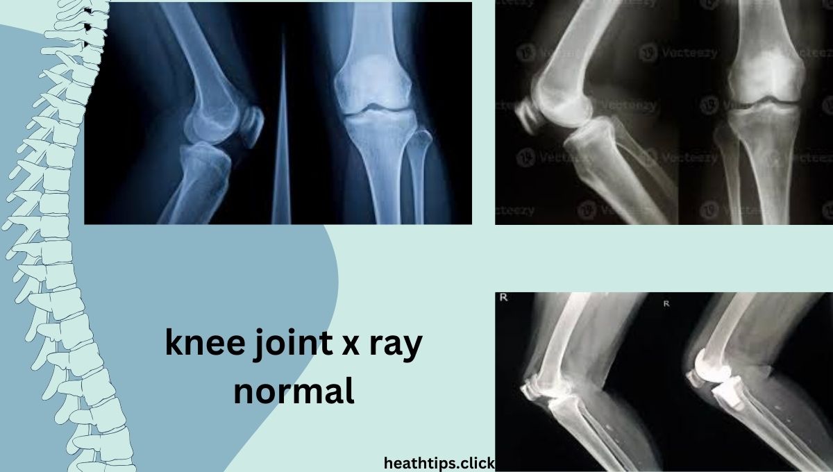 knee joint x ray normal